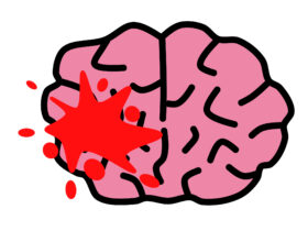 脳出血の初期症状