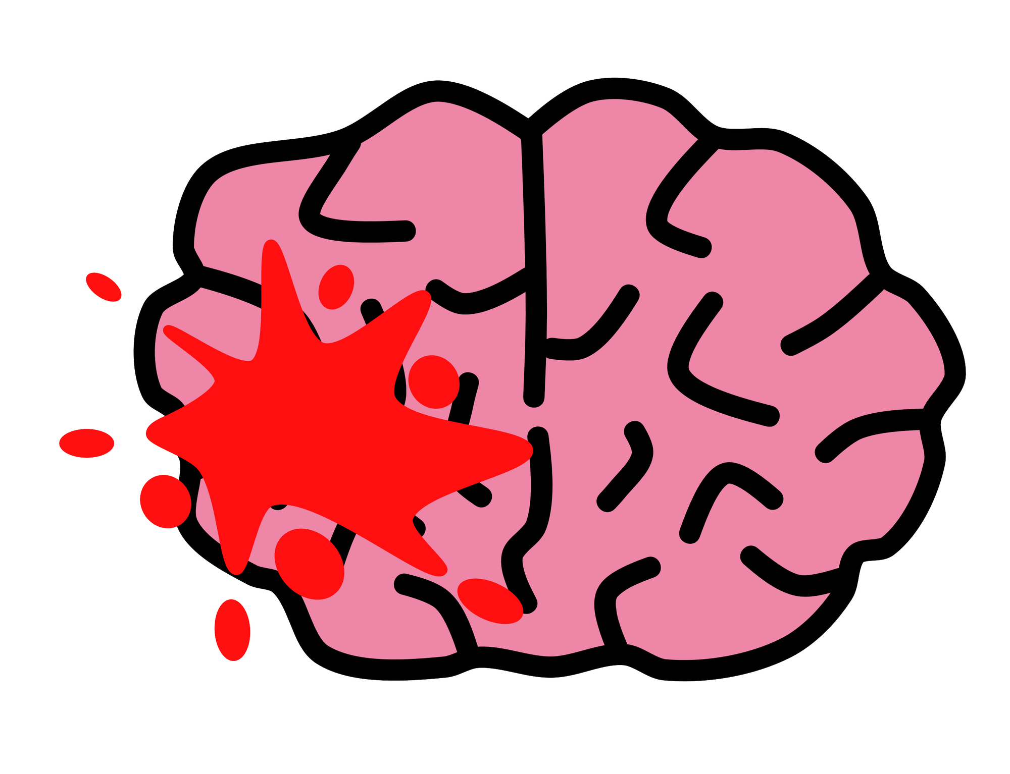 脳内出血はどのように診断されるのですか?